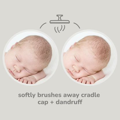 CradleClean Scalp Brush Set